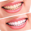 TEETH ORAL WHITENING KIT - magazingeneral
